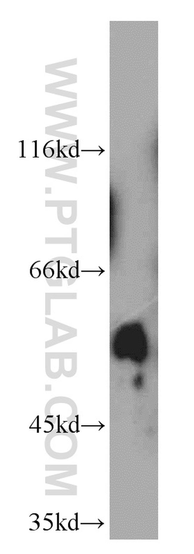 SPPL2A Antibody in Western Blot (WB)