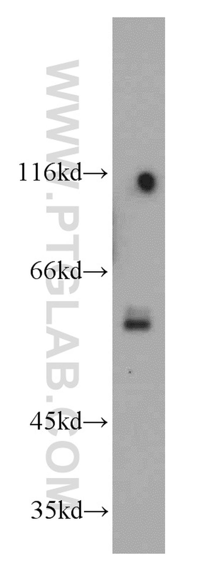 SPPL2A Antibody in Western Blot (WB)