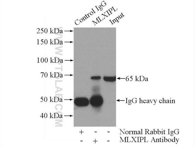 MLXIPL Antibody in Immunoprecipitation (IP)