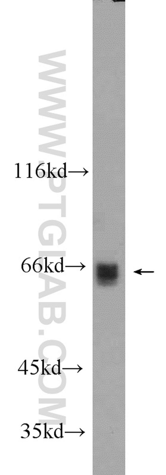 MLXIPL Antibody in Western Blot (WB)