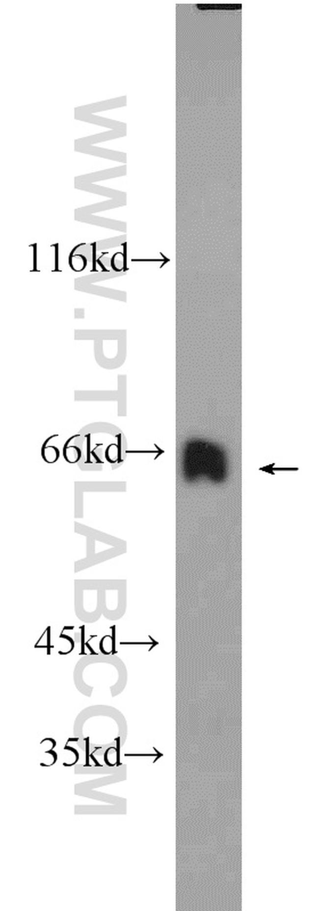 MLXIPL Antibody in Western Blot (WB)