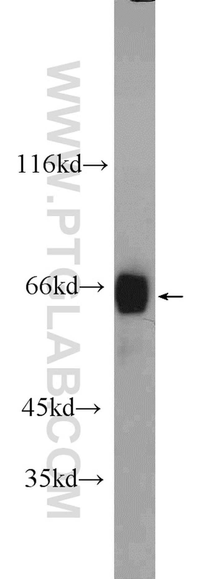 MLXIPL Antibody in Western Blot (WB)