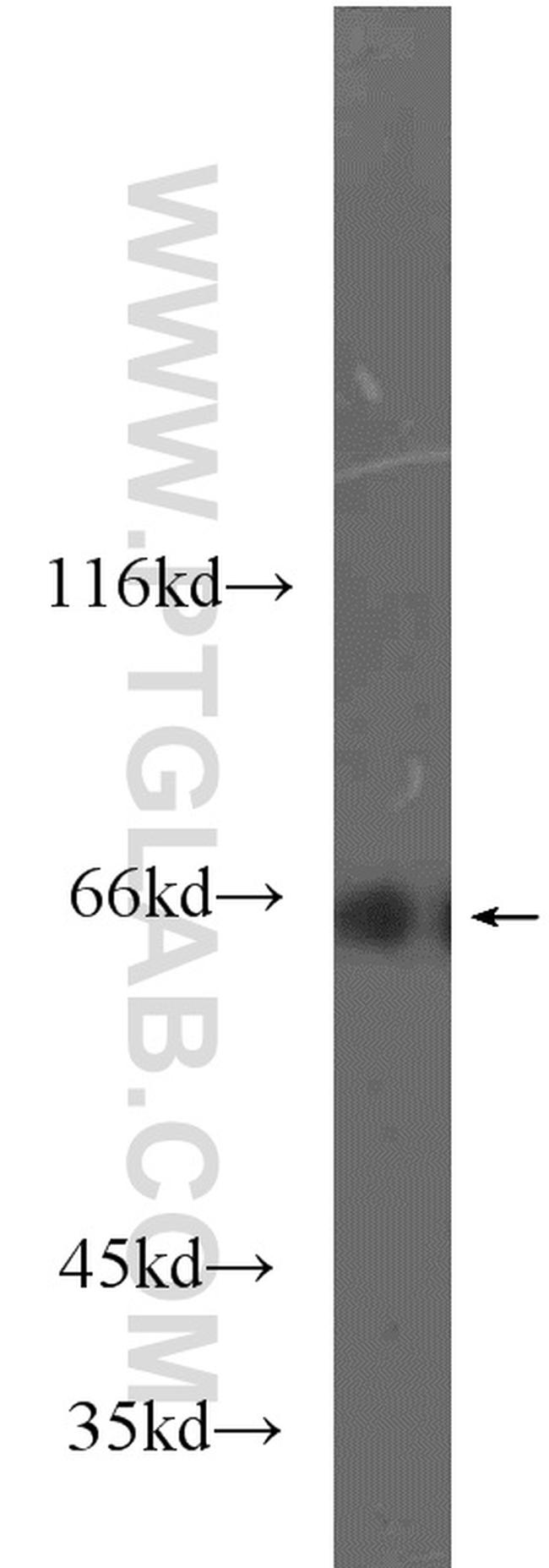 MLXIPL Antibody in Western Blot (WB)