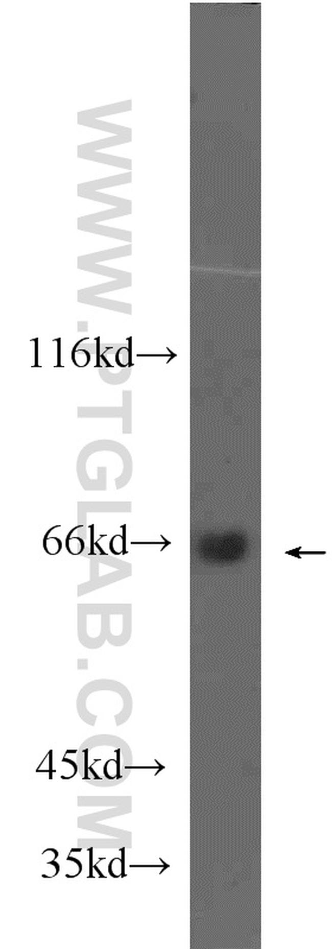 MLXIPL Antibody in Western Blot (WB)