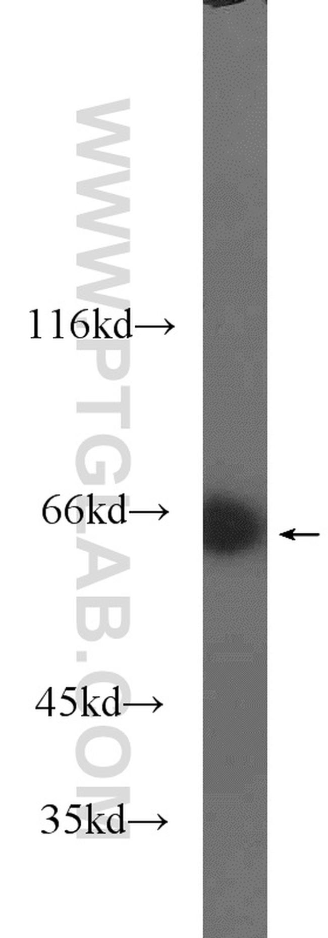 MLXIPL Antibody in Western Blot (WB)