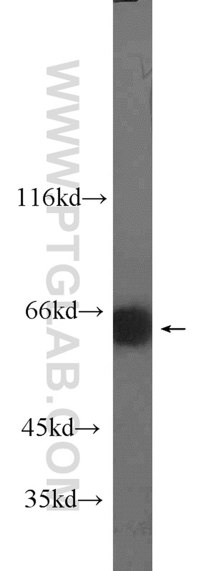 MLXIPL Antibody in Western Blot (WB)