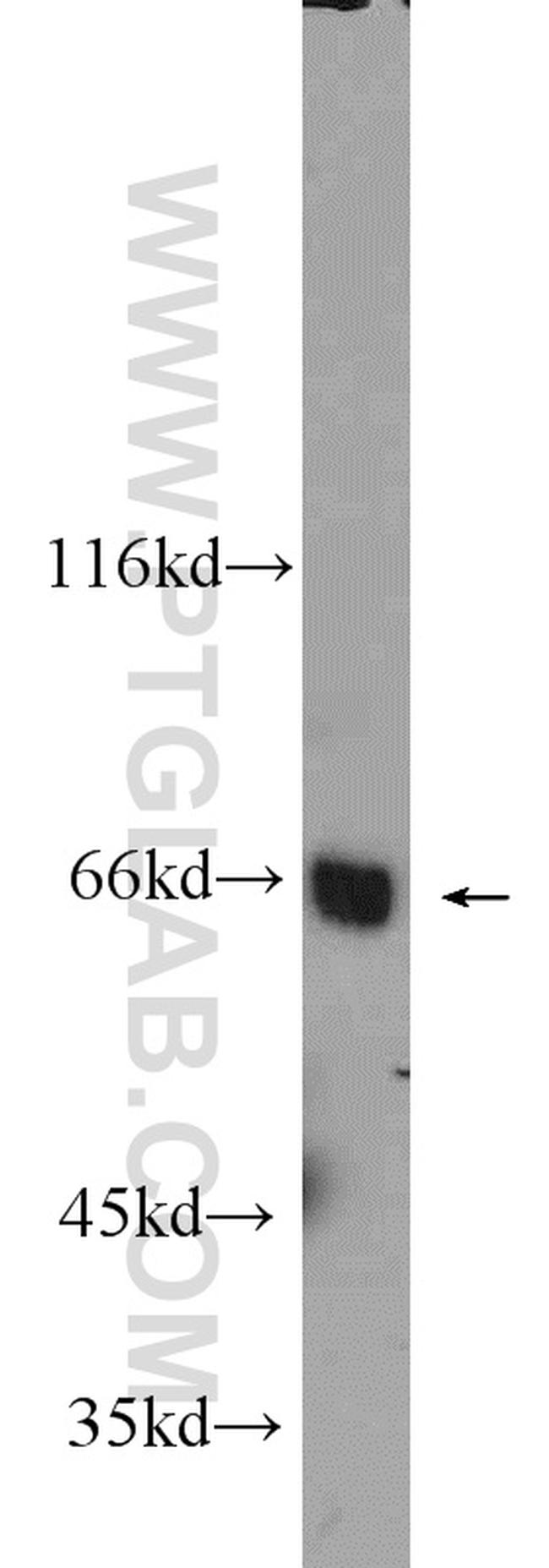 MLXIPL Antibody in Western Blot (WB)