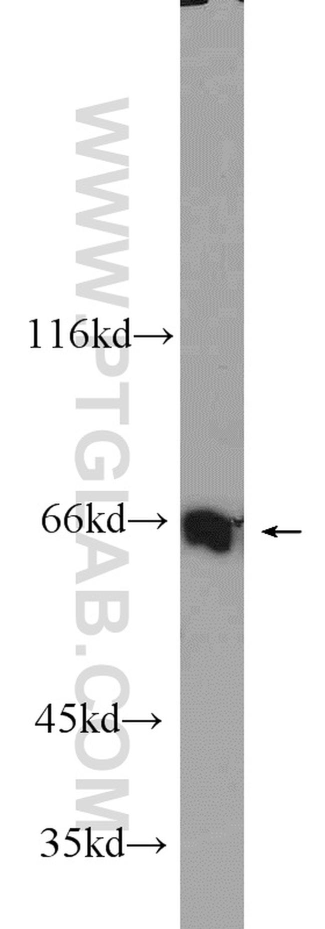 MLXIPL Antibody in Western Blot (WB)