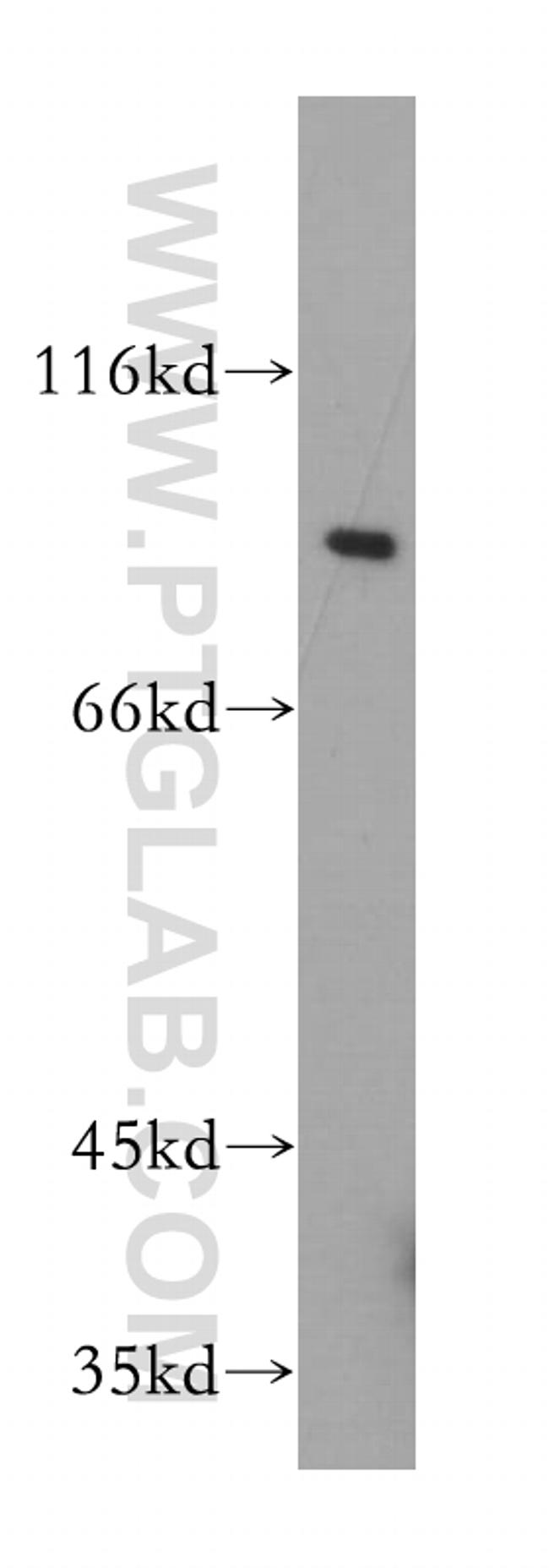 Gamma adaptin Antibody in Western Blot (WB)