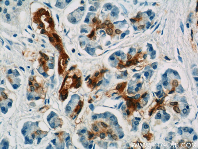 Gamma adaptin Antibody in Immunohistochemistry (Paraffin) (IHC (P))