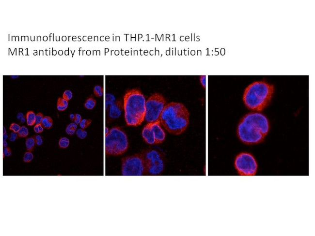 MR1 Antibody in Immunocytochemistry (ICC/IF)