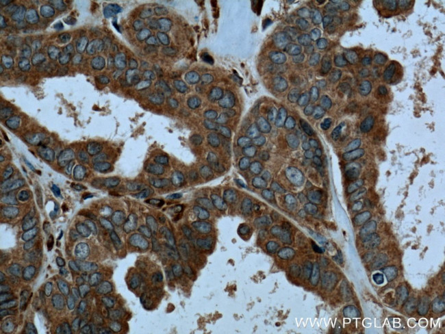 CaMKIV Antibody in Immunohistochemistry (Paraffin) (IHC (P))