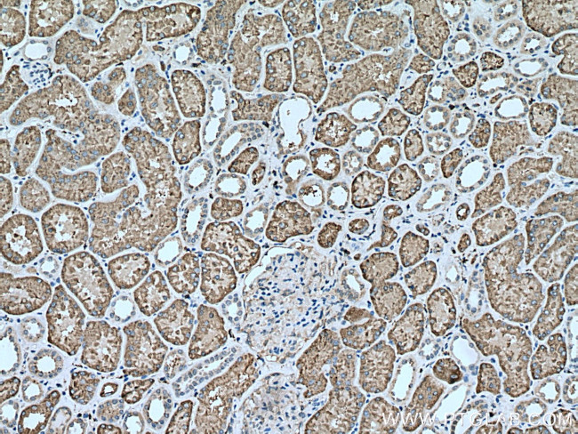 GGH Antibody in Immunohistochemistry (Paraffin) (IHC (P))