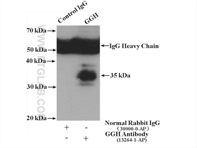 GGH Antibody in Immunoprecipitation (IP)