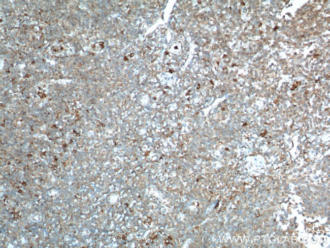 IDO1 Antibody in Immunohistochemistry (Paraffin) (IHC (P))