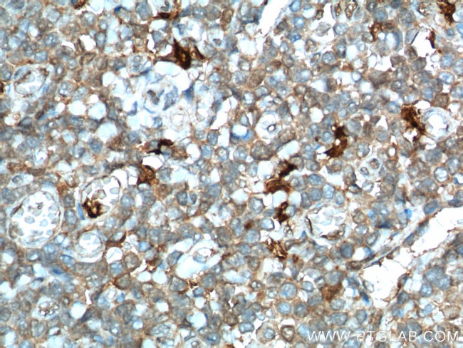 IDO1 Antibody in Immunohistochemistry (Paraffin) (IHC (P))