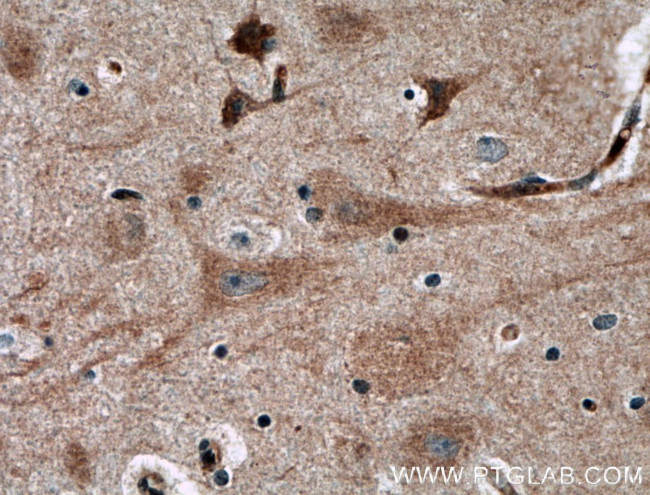 NGEF Antibody in Immunohistochemistry (Paraffin) (IHC (P))