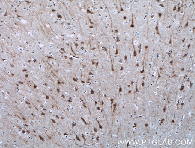 NGEF Antibody in Immunohistochemistry (Paraffin) (IHC (P))