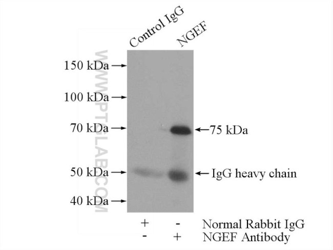 NGEF Antibody in Immunoprecipitation (IP)