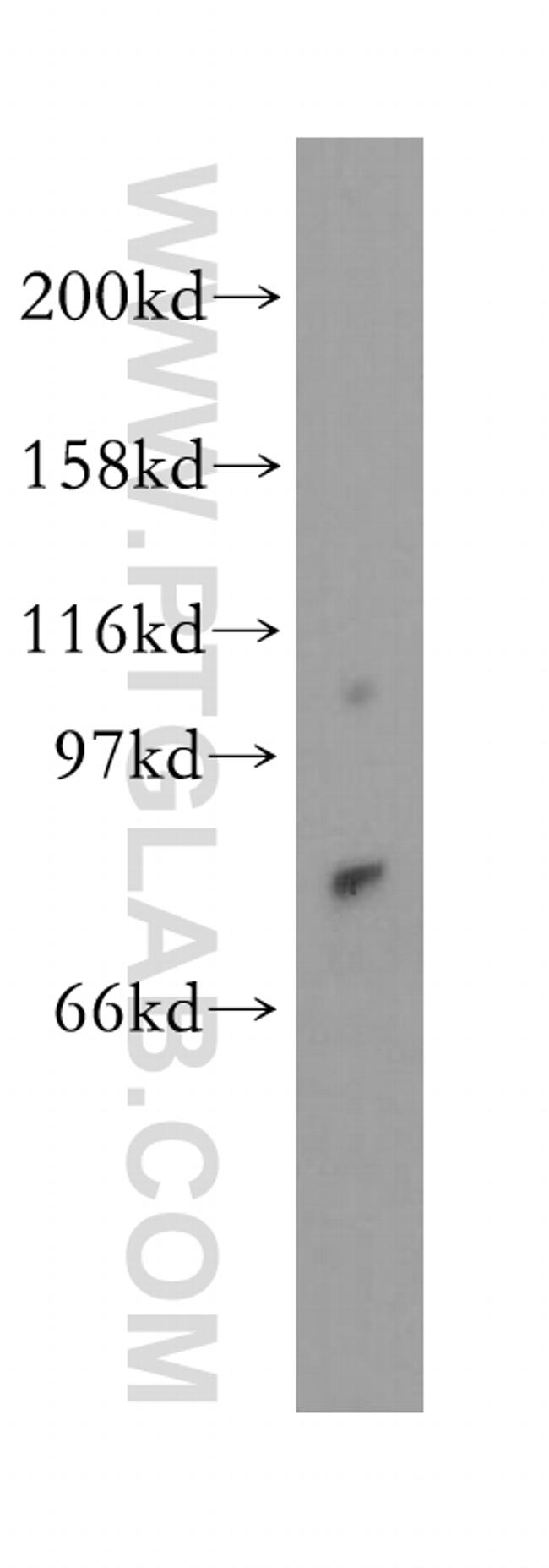 NGEF Antibody in Western Blot (WB)