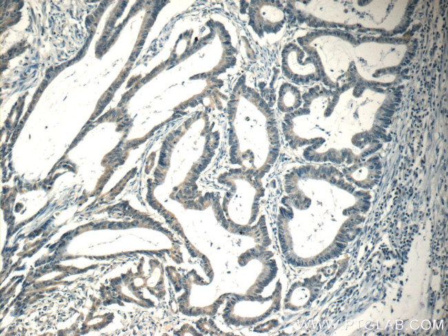 CPEB1 Antibody in Immunohistochemistry (Paraffin) (IHC (P))