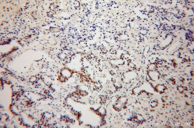 NXF3 Antibody in Immunohistochemistry (Paraffin) (IHC (P))