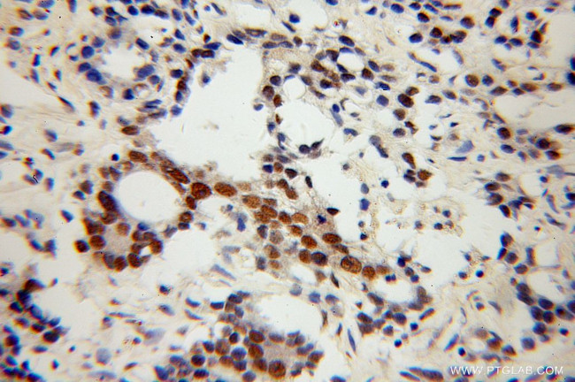 NXF3 Antibody in Immunohistochemistry (Paraffin) (IHC (P))