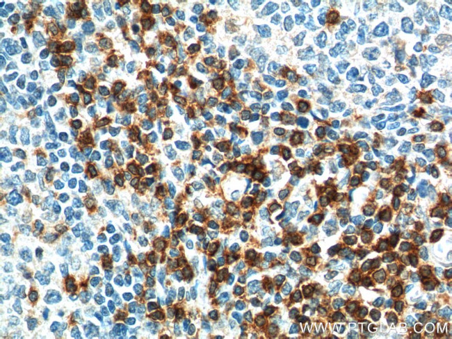 TRAT1 Antibody in Immunohistochemistry (Paraffin) (IHC (P))