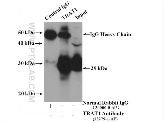 TRAT1 Antibody in Immunoprecipitation (IP)