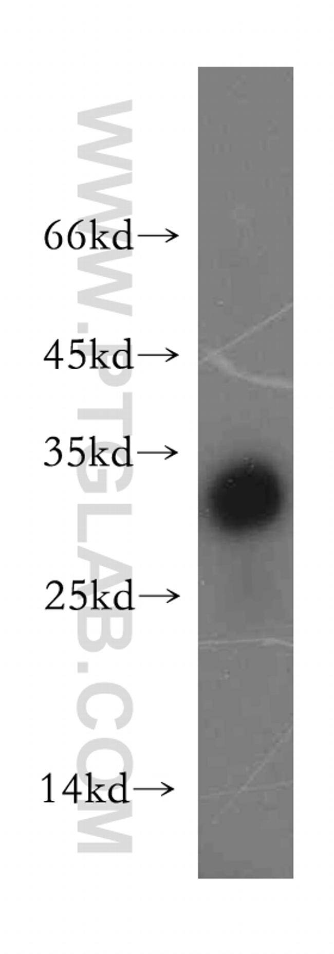 TRAT1 Antibody in Western Blot (WB)