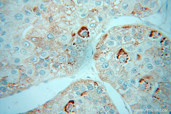 ZBP1 Antibody in Immunohistochemistry (Paraffin) (IHC (P))