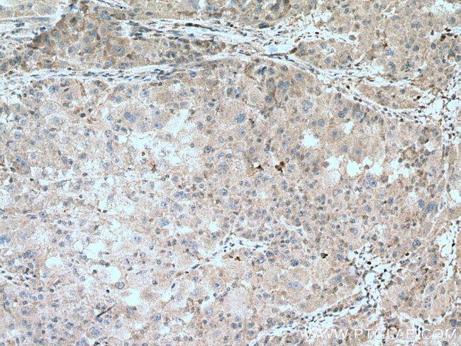 ZBP1 Antibody in Immunohistochemistry (Paraffin) (IHC (P))