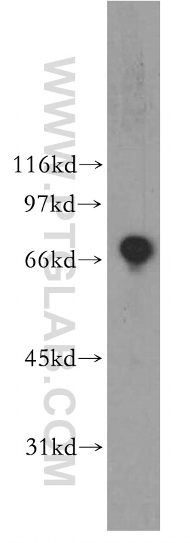 ZBP1 Antibody in Western Blot (WB)