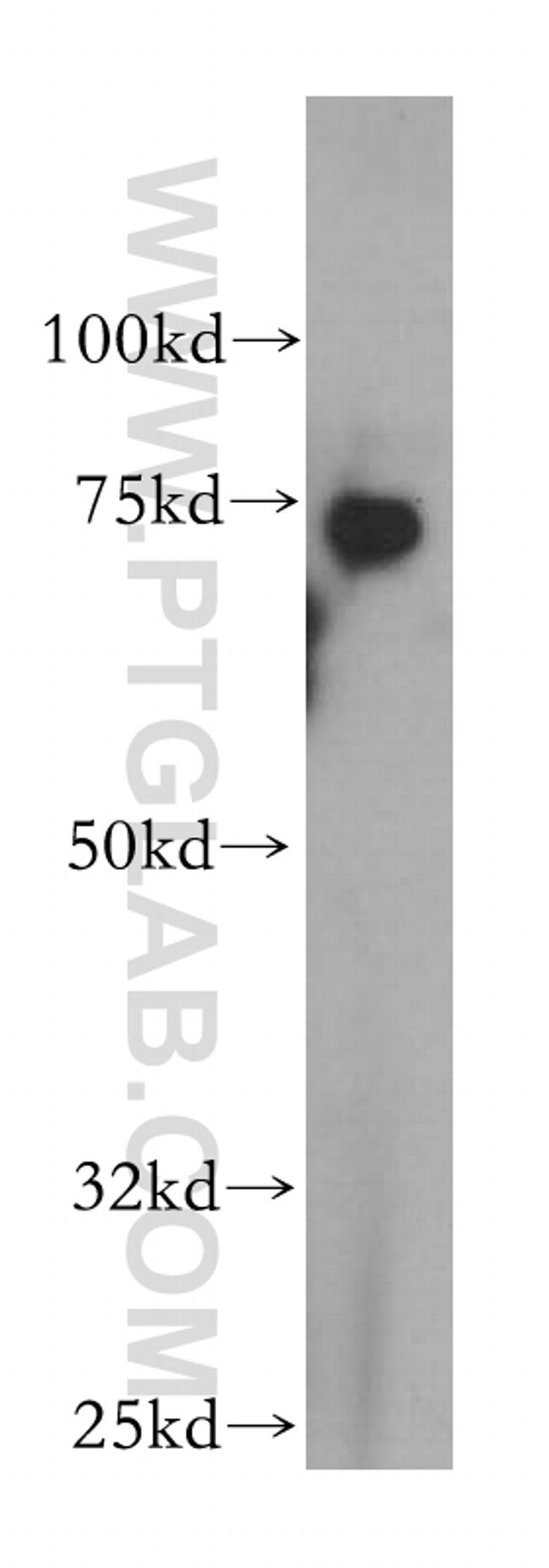 ZBP1 Antibody in Western Blot (WB)