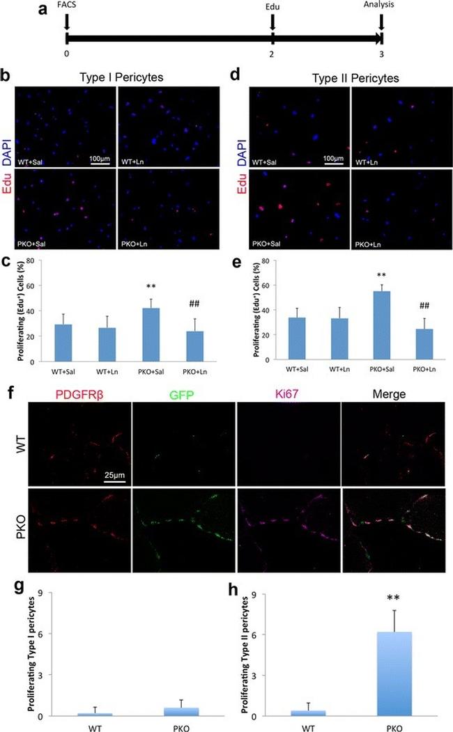 CD140b (PDGFRB) Antibody in Immunohistochemistry (IHC)