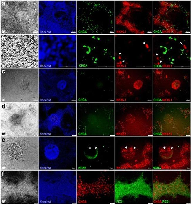 Chromogranin A Antibody in Immunocytochemistry (ICC/IF)