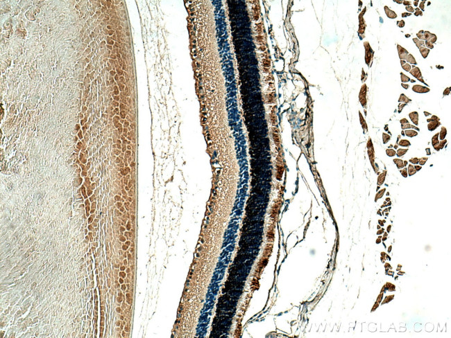 RDH12 Antibody in Immunohistochemistry (Paraffin) (IHC (P))