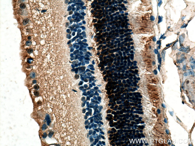 RDH12 Antibody in Immunohistochemistry (Paraffin) (IHC (P))