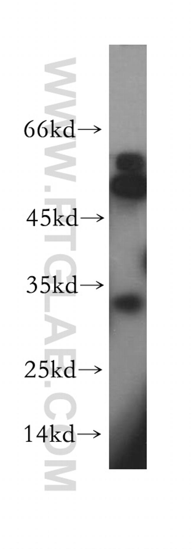 RDH12 Antibody in Western Blot (WB)