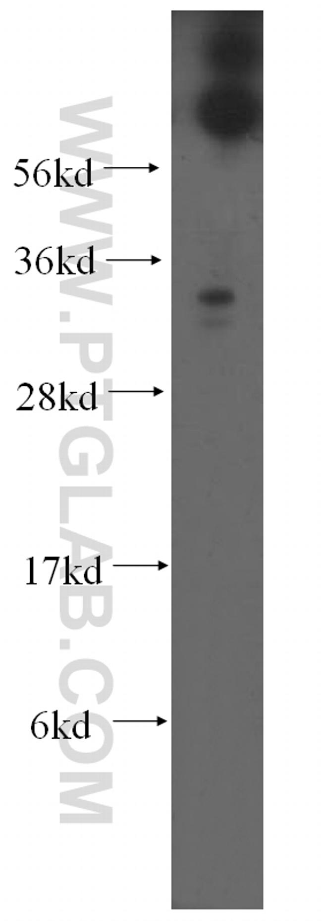 RDH12 Antibody in Western Blot (WB)