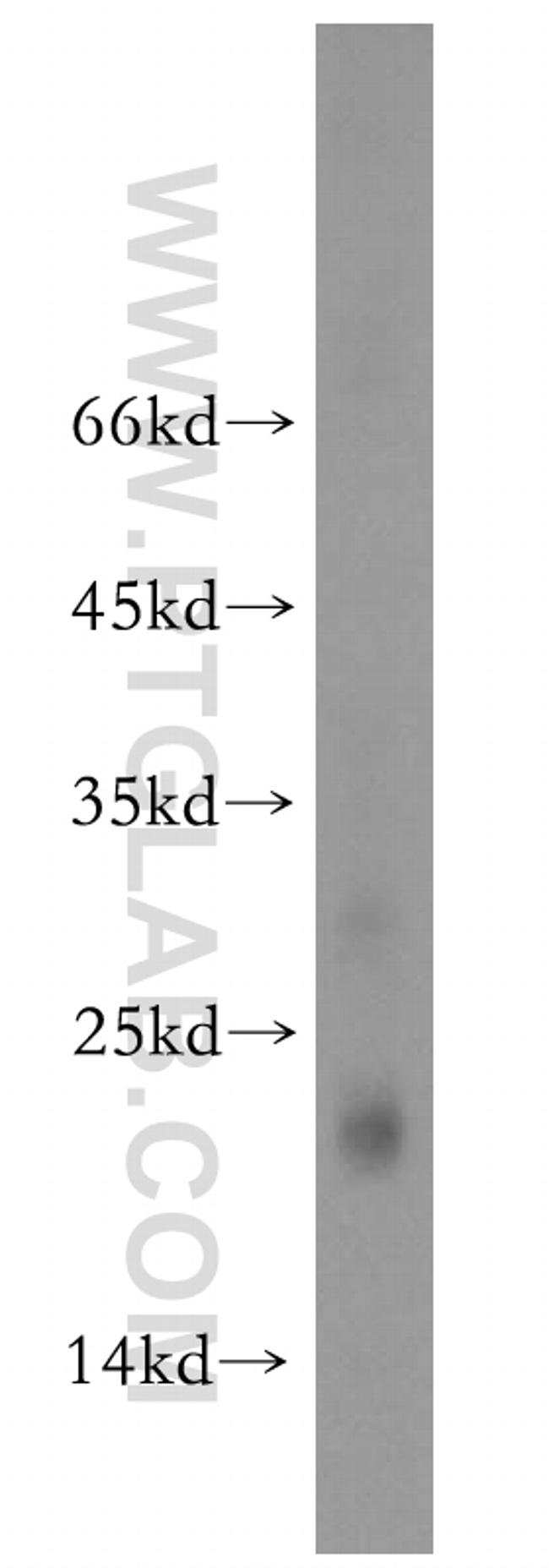 RNF125 Antibody in Western Blot (WB)