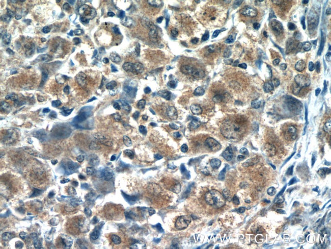 RNF125 Antibody in Immunohistochemistry (Paraffin) (IHC (P))