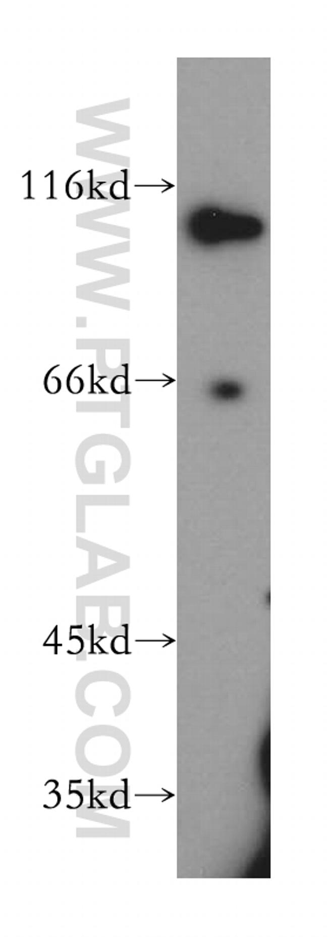 SNX25 Antibody in Western Blot (WB)
