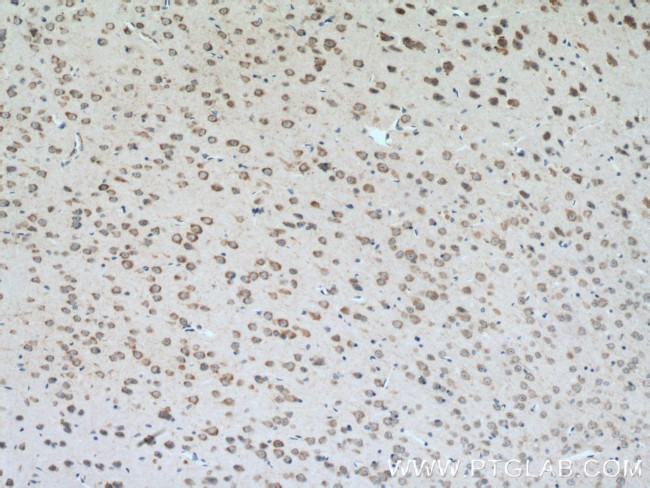 CLSTN3 Antibody in Immunohistochemistry (Paraffin) (IHC (P))