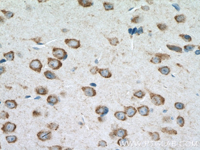 CLSTN3 Antibody in Immunohistochemistry (Paraffin) (IHC (P))