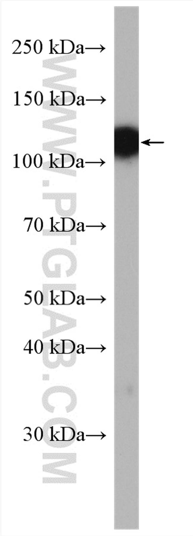 CLSTN3 Antibody in Western Blot (WB)