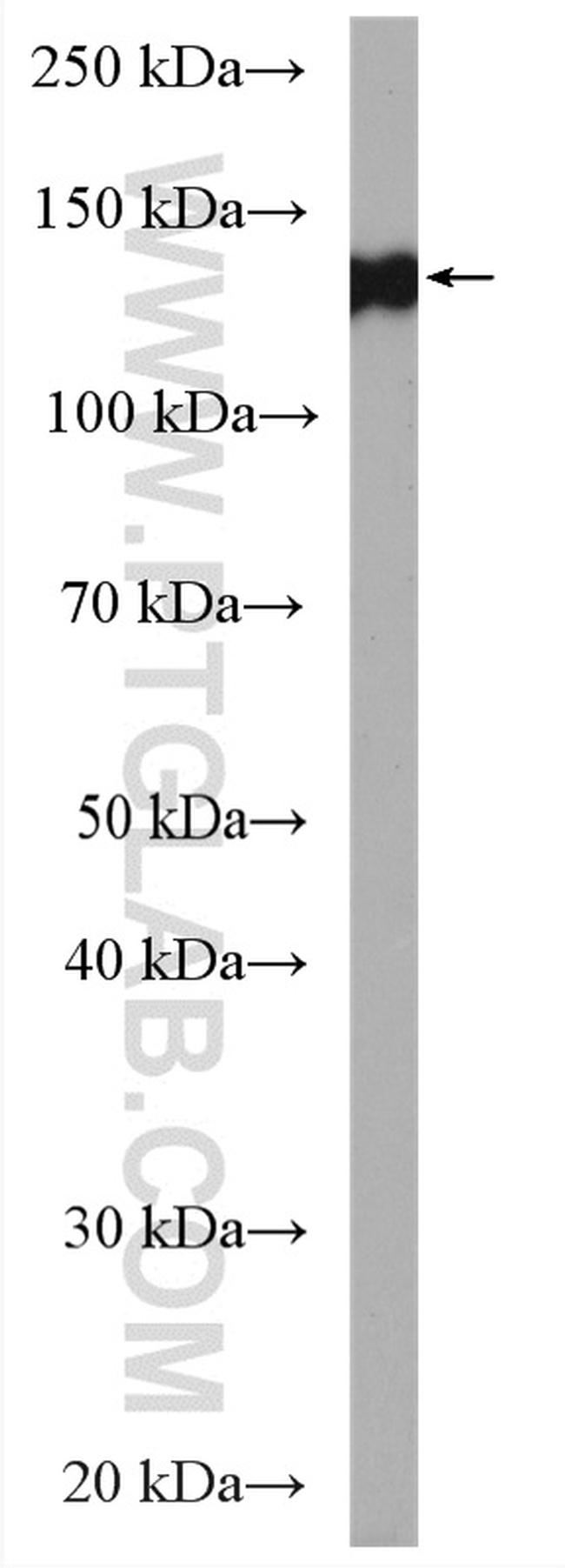 CLSTN3 Antibody in Western Blot (WB)