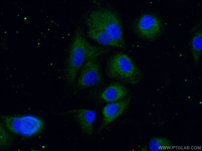 VASH2 Antibody in Immunocytochemistry (ICC/IF)