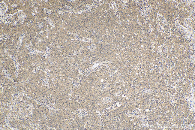 VASH2 Antibody in Immunohistochemistry (Paraffin) (IHC (P))