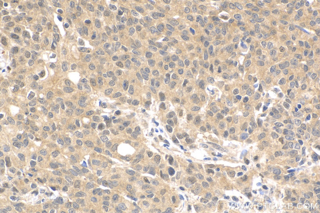 VASH2 Antibody in Immunohistochemistry (Paraffin) (IHC (P))